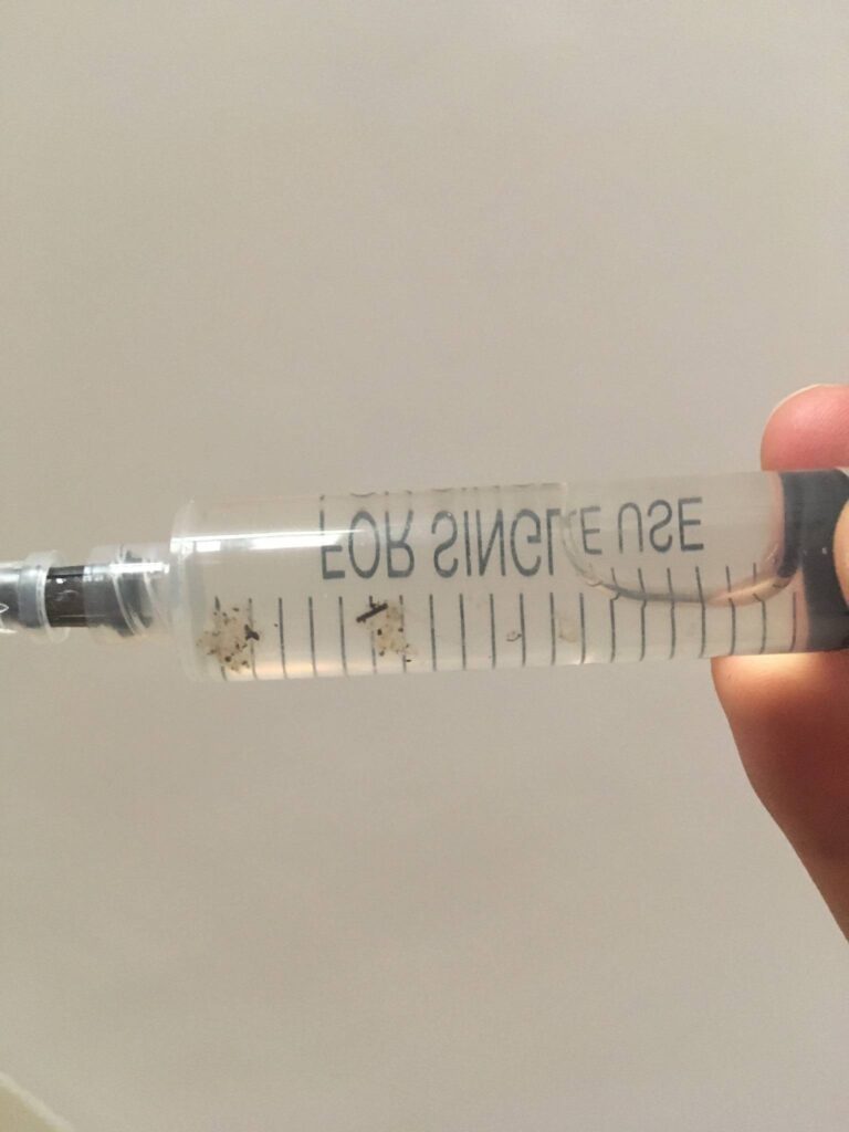 contaminated spore syringe
