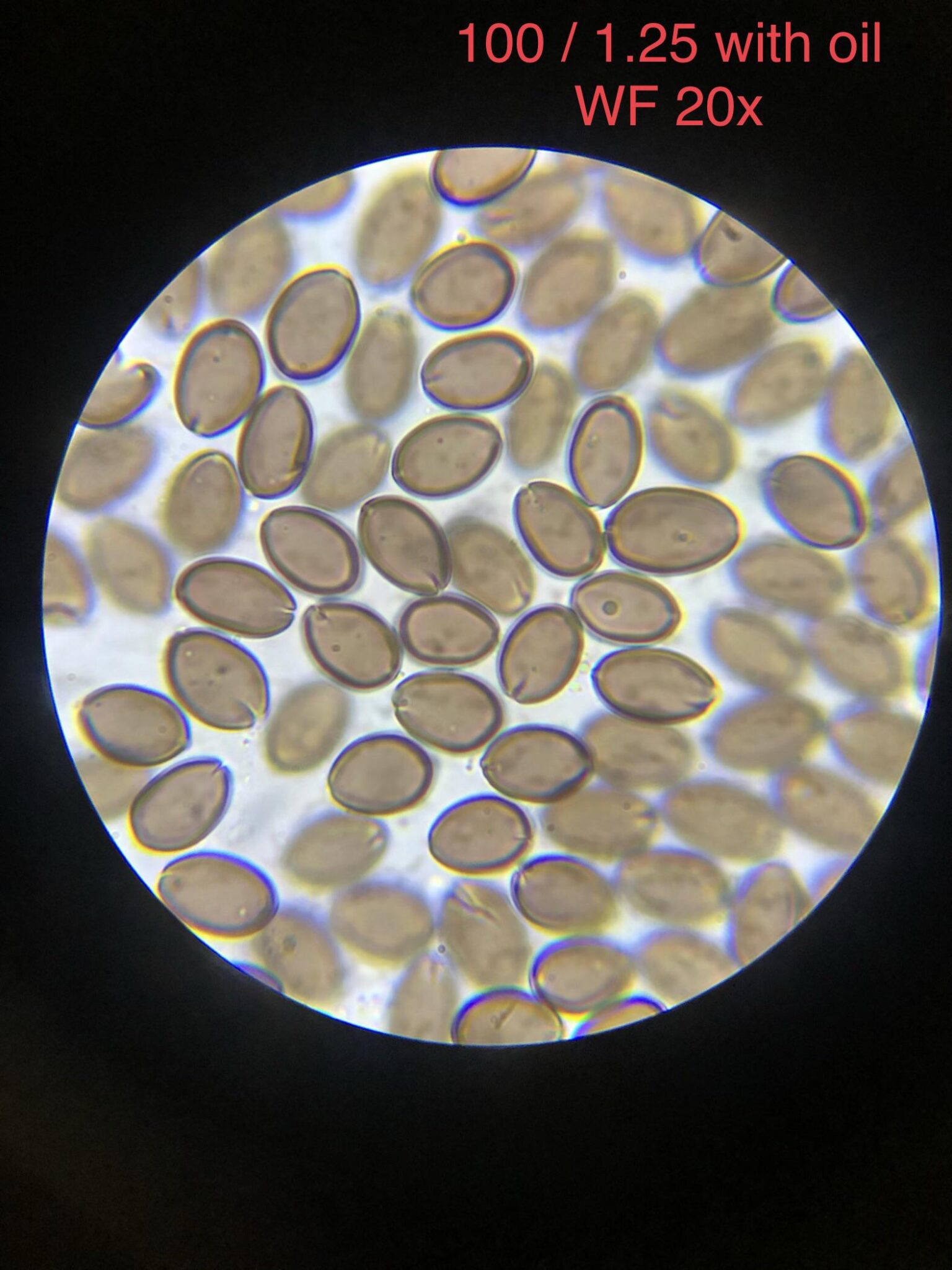 What Are Mushroom Spores?